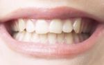 Gesundheitsbeschwerden durch Zahnprobleme - berraschende Zusammenhnge