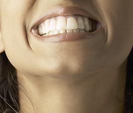 Zahngesund durch die Schwangerschaft - sorgfltige Mundhygiene ist wichtig